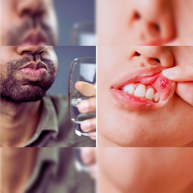 Mint and Dental Health