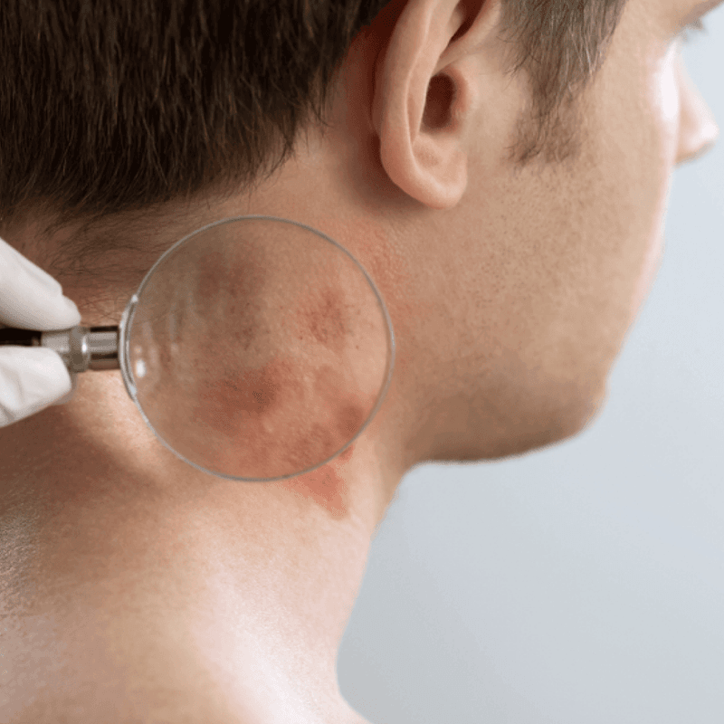 Mint's Influence on Skin Health