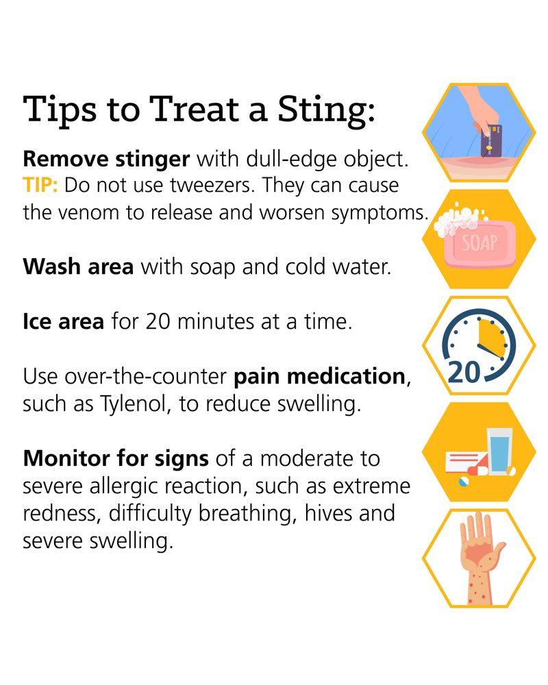 A sting needs basic first aid—and sometimes emergency care