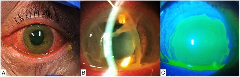 Eye exposure can cause serious injury
