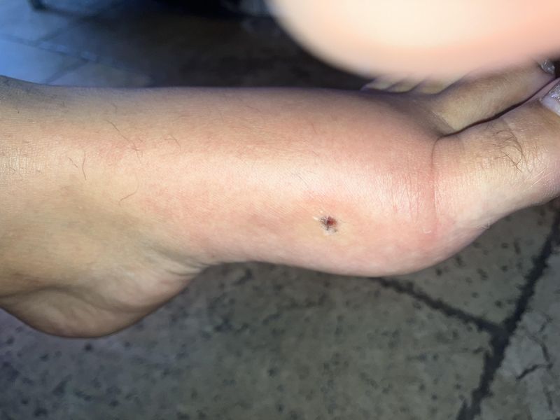 Know which symptoms make this an emergency
