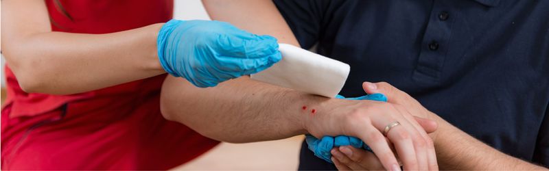 Wash a suspected bite and get expert advice